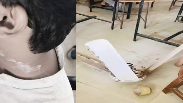 রুয়েটে শ্রেণিকক্ষে সিলিং ফ্যান পড়ে শিক্ষার্থী আহত